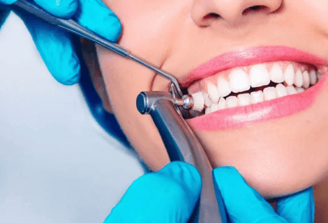 Teeth Cleaning | Dental Cleaning