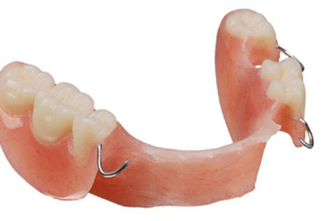 Removable Partial Dentures Or Removable Teeth