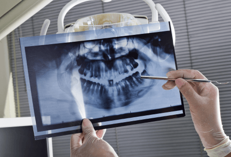 Dental Exams and X-Rays