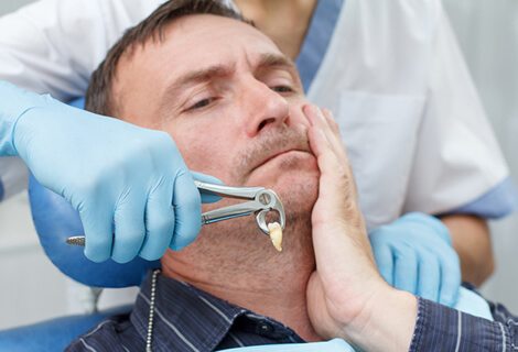 Tooth Extraction Surgery in Rockledge