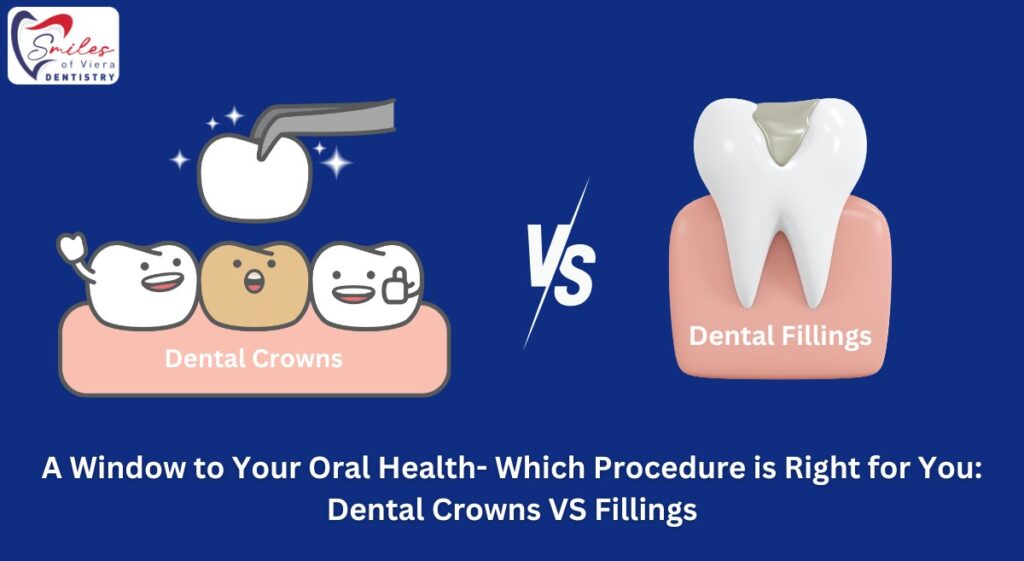 Dental Crowns VS Fillings | Dr. M. Ahmed