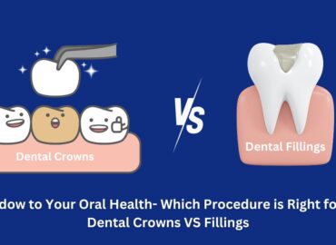 Dental Crowns VS Fillings | Dr. M. Ahmed