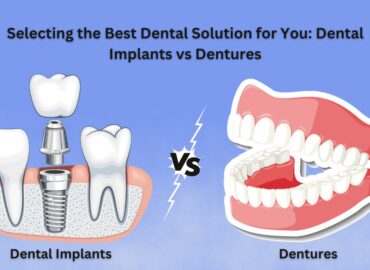 Dental Implants vs Dentures | Dr. M. Ahmed