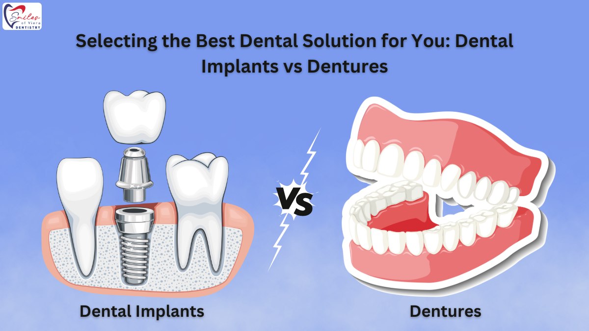 Dental Implants vs Dentures | Dr. M. Ahmed