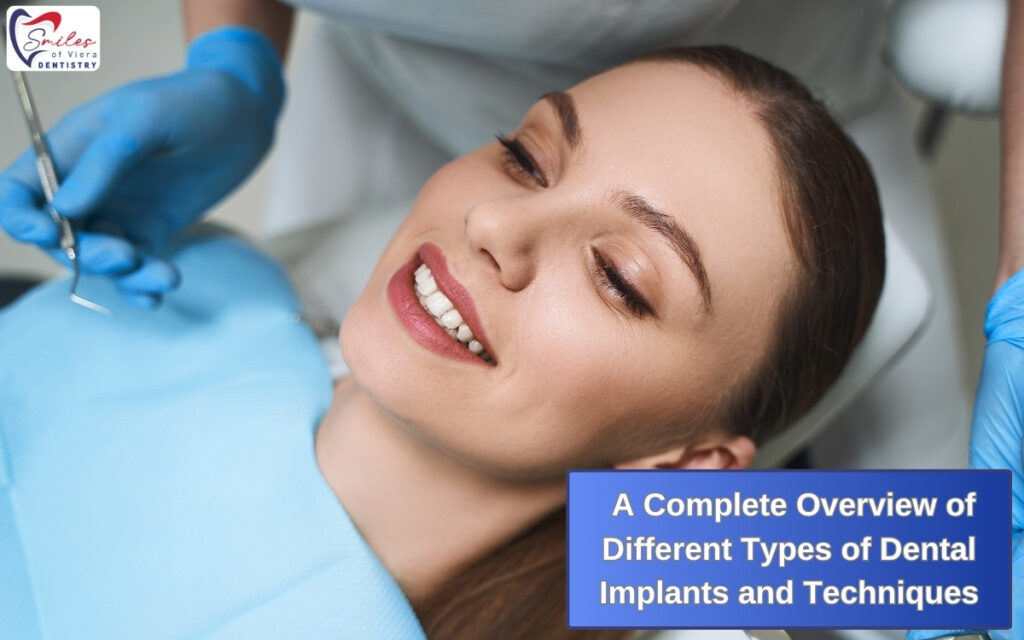 A Complete Overview of Different Types of Dental Implants and Techniques