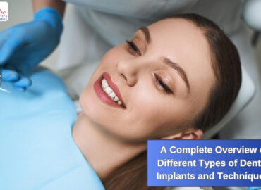 A Complete Overview of Different Types of Dental Implants and Techniques