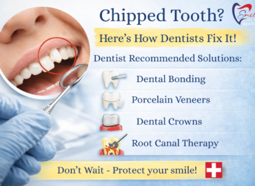 Chipped Tooth