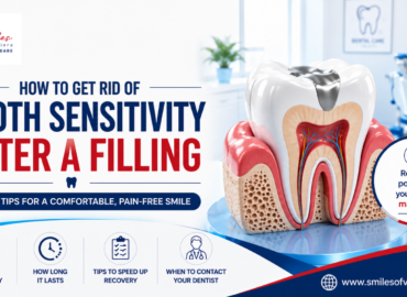 Smiles of viera blog Professional dental explaining how to relieve tooth sensitivity after a dental filling.